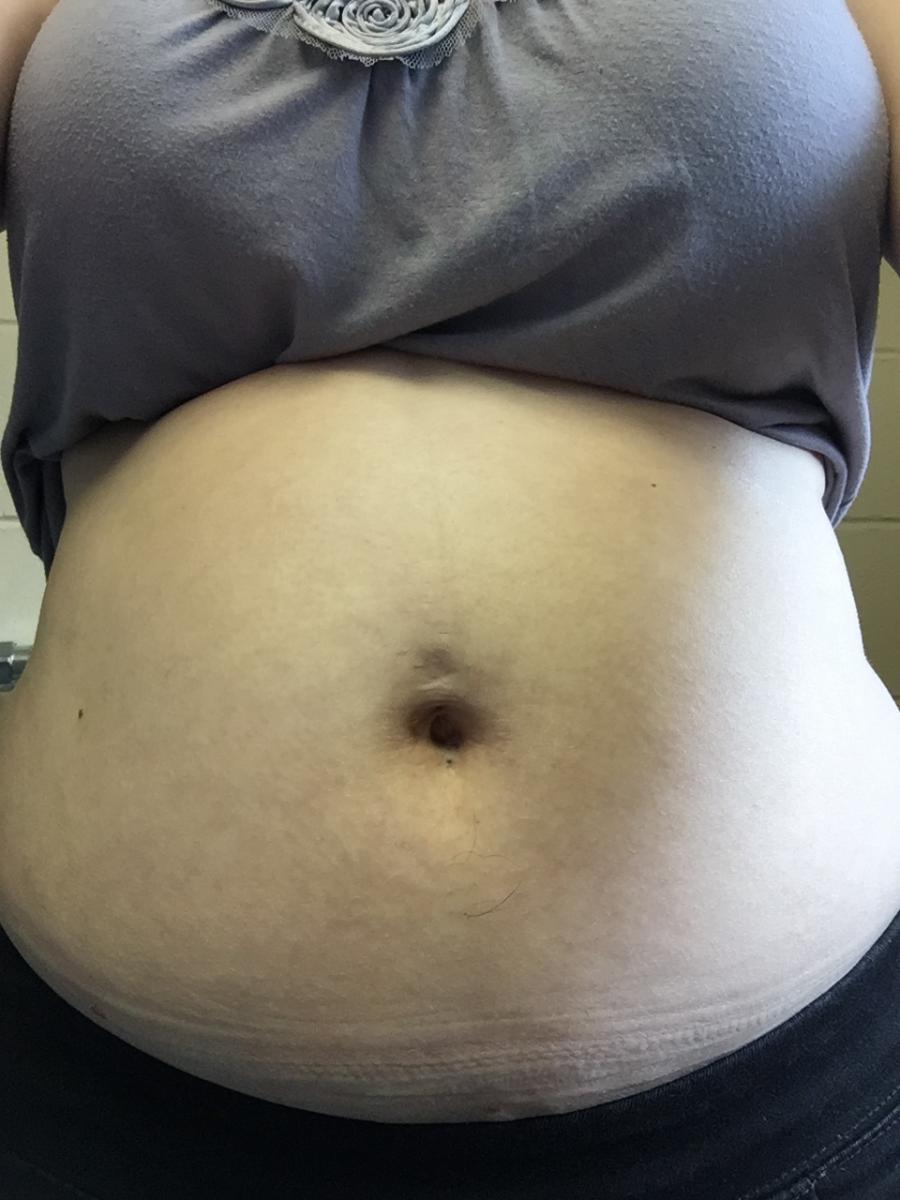 Erin's belly