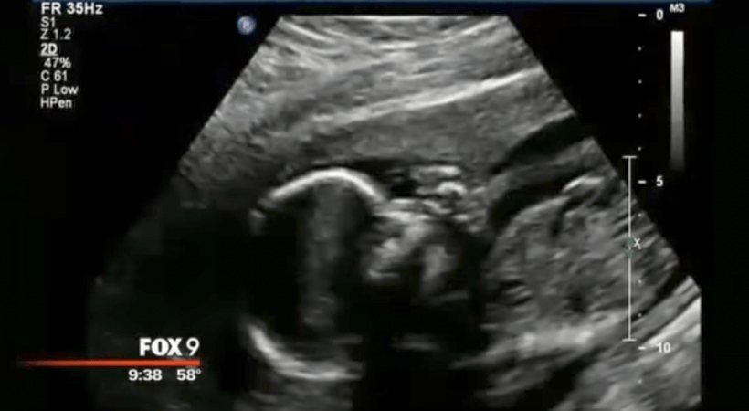 image credit Fox News 9 via YouTube image credit Fox News 9 via YouTube