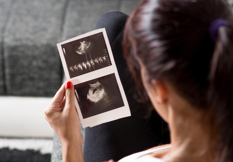 The moral of this story is that early ultrasounds can vary wildly and that you should probably not do what I did by obsessively Googling things. The moral of this story is that early ultrasounds can vary wildly and that you should probably not do what I did by obsessively Googling things.