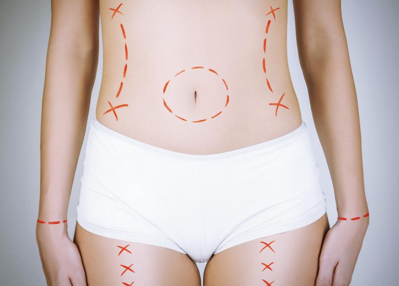 Credit: ThinkStock Credit: ThinkStock