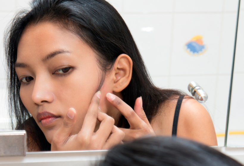 Acne Awareness Month 7 Bad Habits That Eff Up Your Face Ravishly